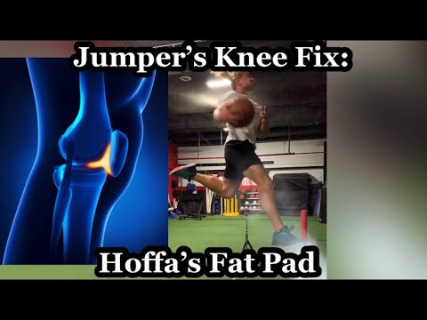 Jumper’s Knee: Hoffa’s Fat Pad (Fix Patellar Tendon Pain)