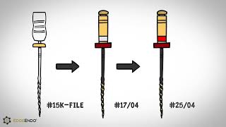EdgeEndo® EdgeFile® X7