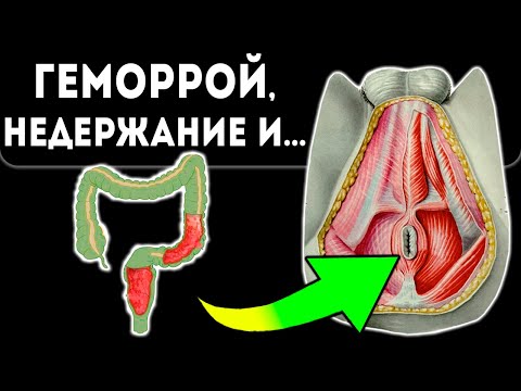 Durerea pelvină | ROmedic