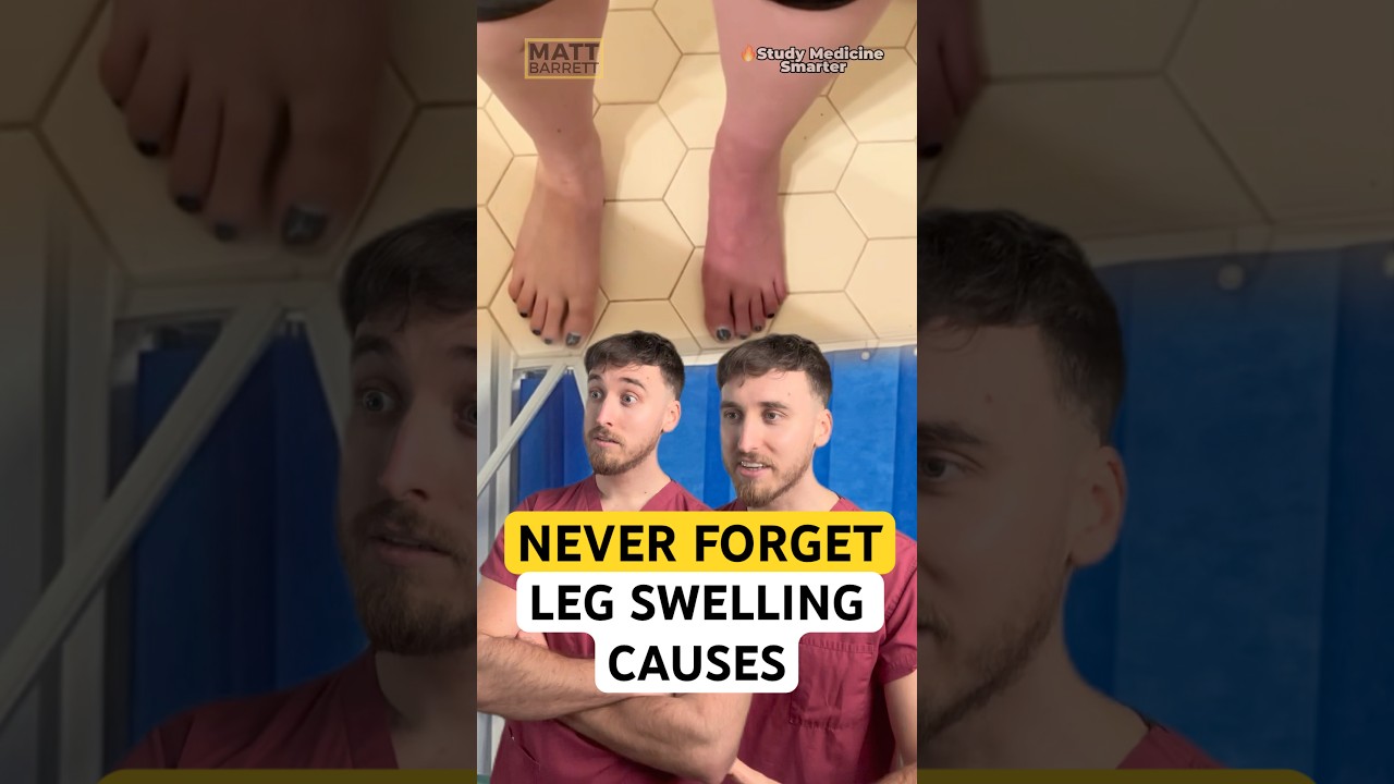 Trick to remember swollen leg causes