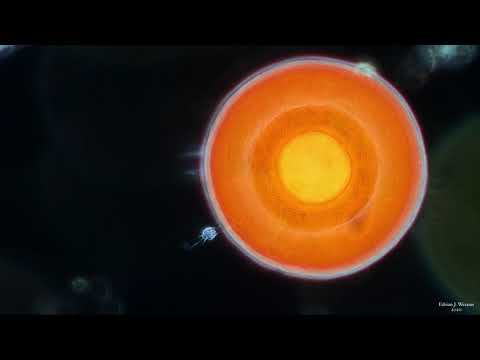 Choanoflagellate Rides Arcella