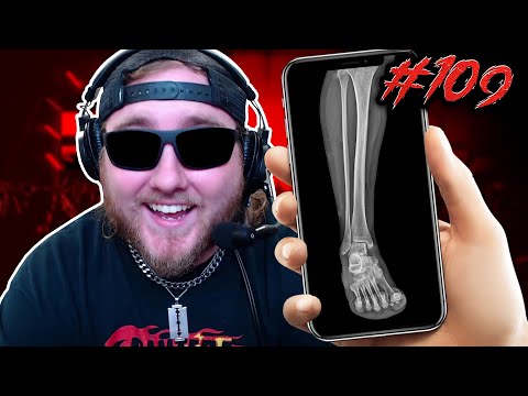 The $1,000,000 leg - GOONS #109