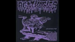 AGATHOCLES - 20 Songs 7'' EP (2012) - full