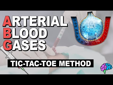 Tic Tac Toe Method | Arterial Blood Gases (Part 5)