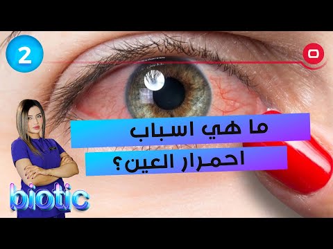 شاهد بالفيديو.. ما هي اسباب احمرار العين؟ - م٣ Biotic - الحلقة ٢