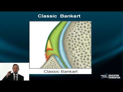 Shoulder Instability MRI: Part V Macroinstability Injuries