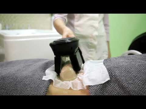 Prima Britannia Laser Clinic fat freezing, Cryolipolysis treatment