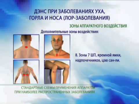 Угол тазобедренного сустава в 3 месяца Сыроедение болят суставы