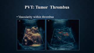 2021 Noninvasive Vascular Imaging - A CME Teaching Activity