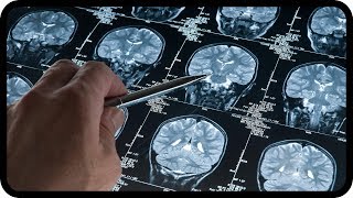 Parkinson und Alzheimer unheilbar? Nein! Neue ursächliche Behandlung