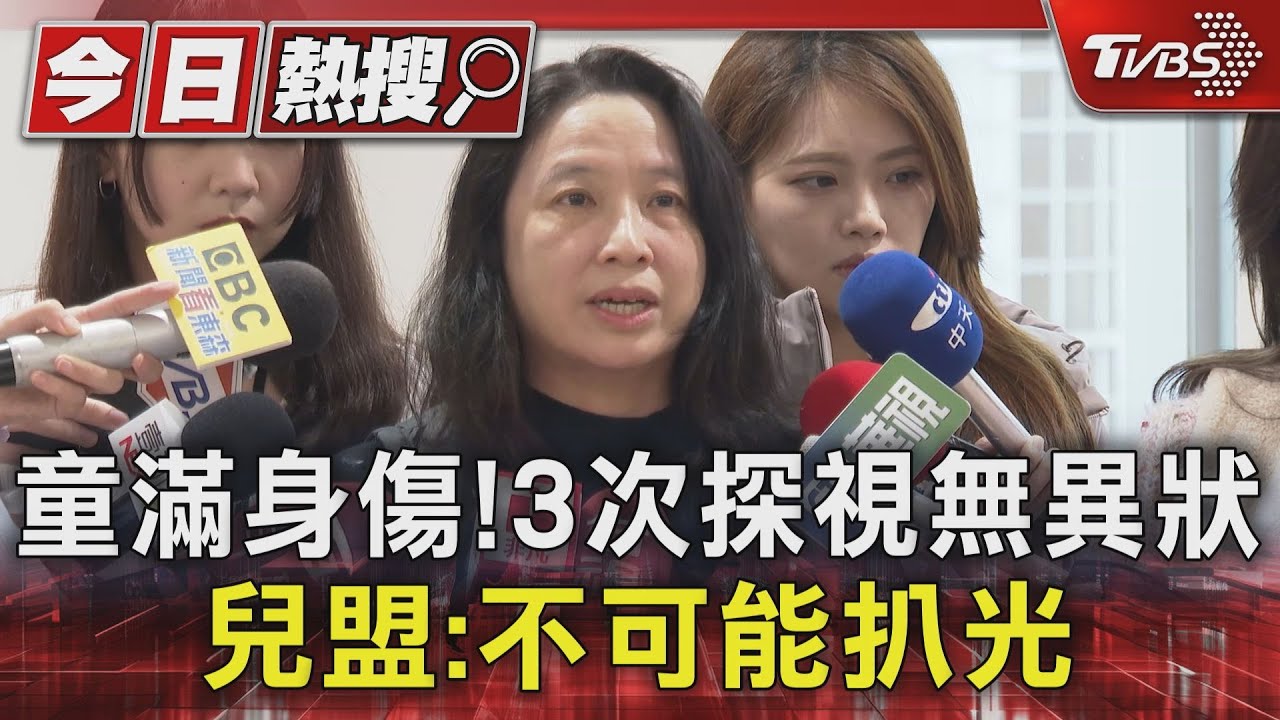 童滿身傷!3次探視無異狀 兒盟:不可能扒光