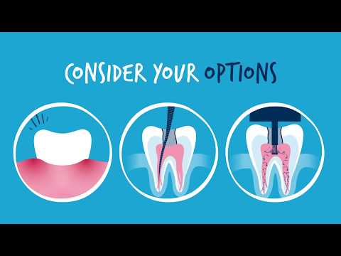 An Effective Alternative to Standard Root Canal Treatment