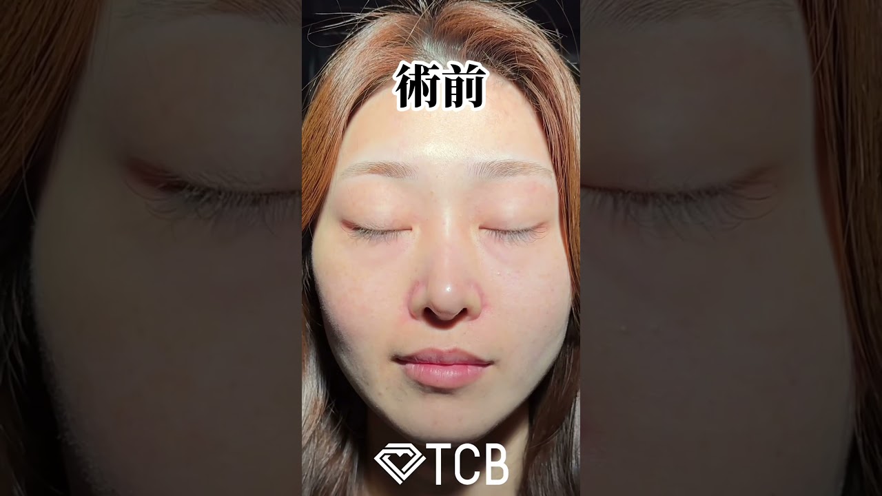 Youtubeのサムネイル