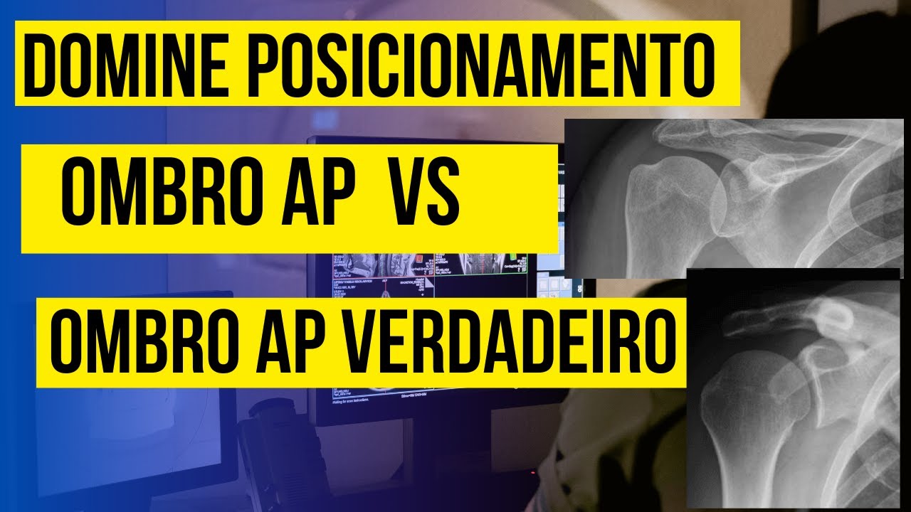 POSICIONAMENTO RADIOLÓGICO DE OMBRO AP E AP VERDADEIRO