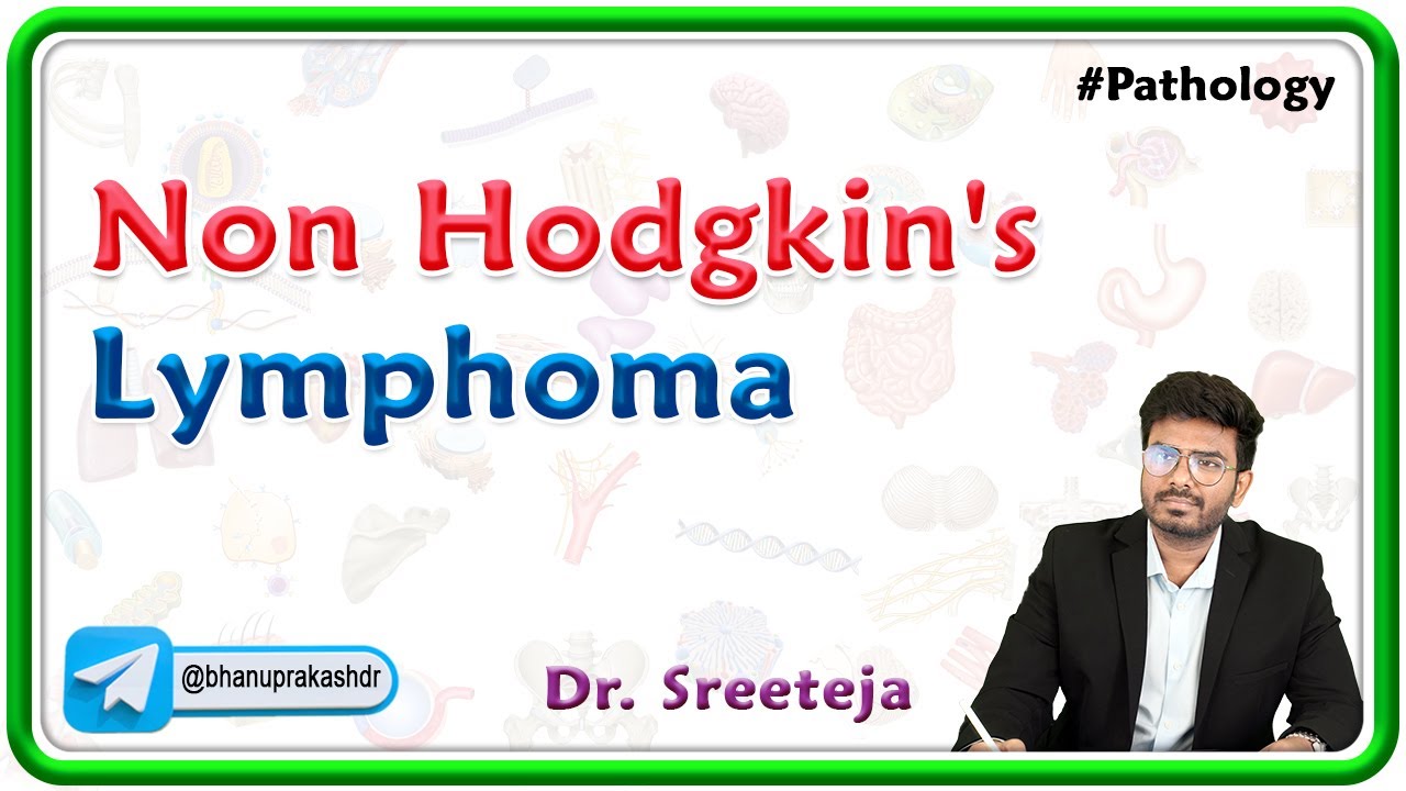 20. Non Hodgkin's Lymphoma | USMLE Step 1 Pathology