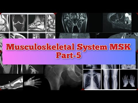 Radiology Viva Cases # 404-408 | Musculoskeletal System Part-5 | MSK #medical #radiology #ultrasound