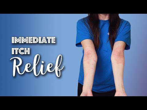 Hypostases di gambe da eczema Ragione di aggravamento neurodermatitis