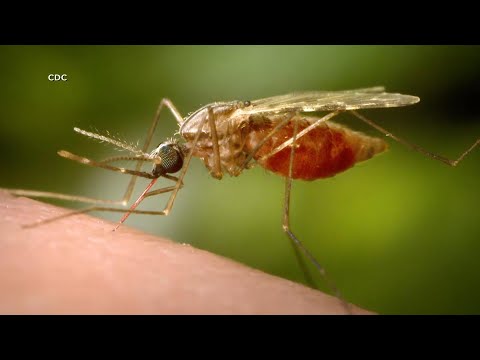 5 Cases of Malaria Found in US After 20 Years Without it
