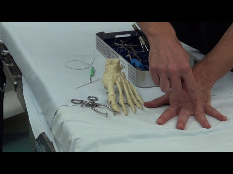 Ask Dr Moore Foot and Ankle FAQ Frequently Asked Questions Video Offering