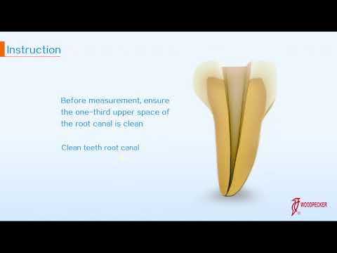 【Operation】- How to use - Woodpex III
