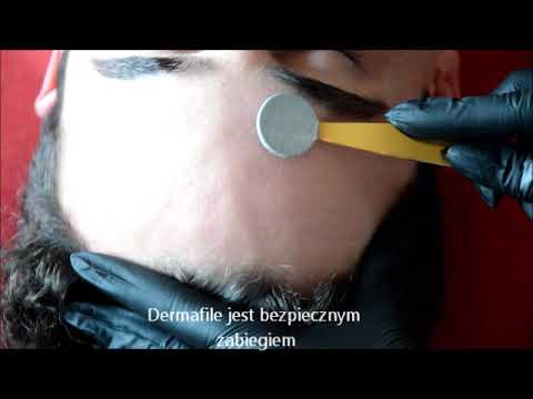 professional dermafile demo video