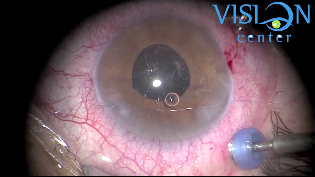 C. Susana Martinez Jardon-18