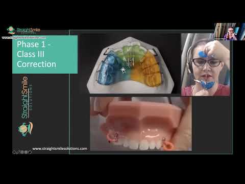 Phase 1 Interceptive Treatment