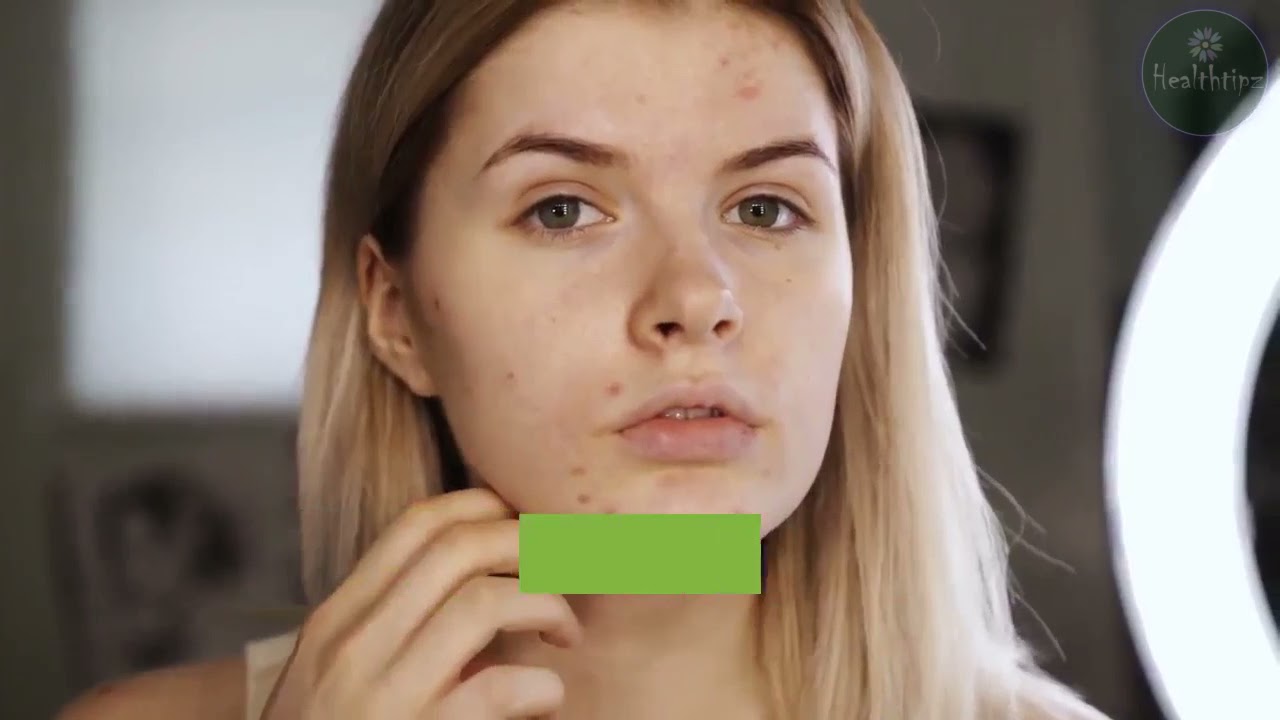 Red Light Therapy for Psoriasis What is it and How Does it Work? Causes, Symptoms, Diagnosis