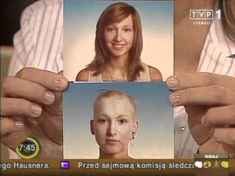 Jak zrobić maskę dla wzrostu włosów do Dimexidum Mumia przydatna na wypadanie włosów