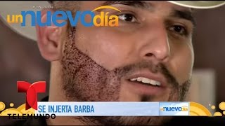 ¡Espinoza Paz se hizo un “transplante” de barba! | Un Nuevo Día | Telemundo