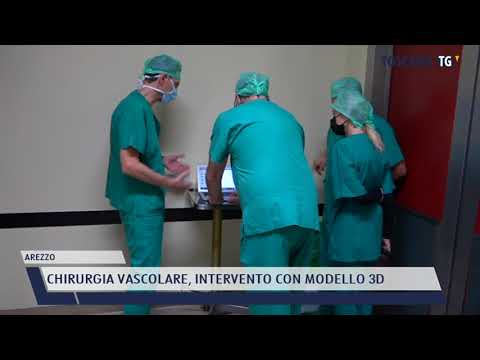 2021-12-07 AREZZO - CHIRURGIA VASCOLARE, INTERVENTO CON MODELLO 3D