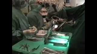 preview picture of video 'Hirnchirurgischer Eingriff - Craniotomy - Νευροχειρουργική Επέμβαση Εγκεφάλου (Thrace-Greece)'