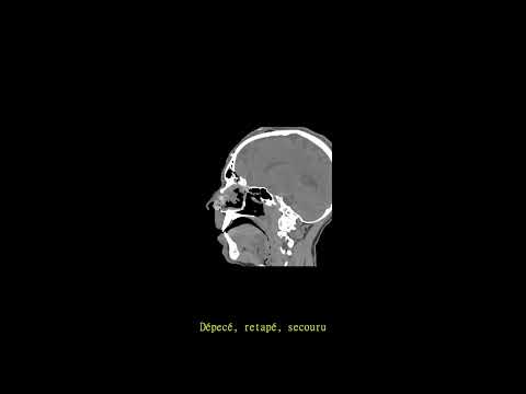 CiZiF & DuDu - la brèche - 03. DÉCOUPÉ