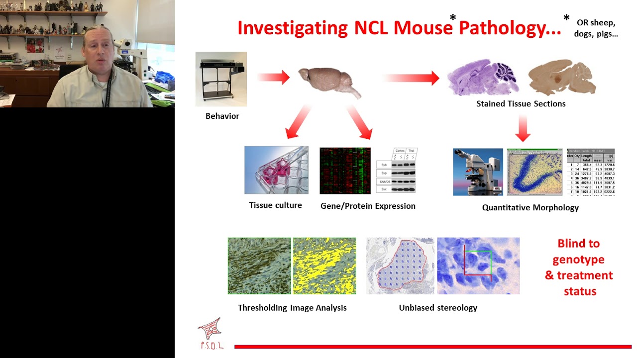 Jonathan D  Cooper, PhDUnderstanding Batten Disease Pathogenesis