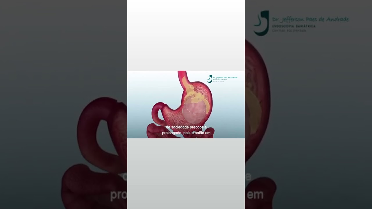 Jefferson Paes De Andrade-52