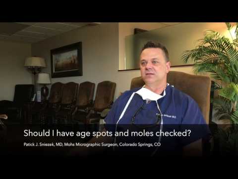 Understanding Skin Cancer, Part 6: When to Check Suspicious Age Spots or Moles for Cancer