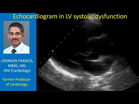 Echocardiogram in left ventricular systolic dysfunction