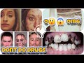{ Part 3}What Happens To Your Body If You Do Meth and Other Drugs