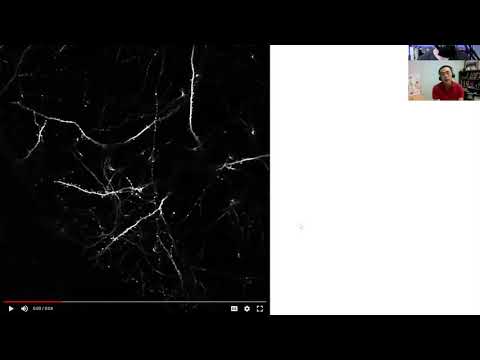 M&M Clips: Images of Mouse Brain After Psilocybin