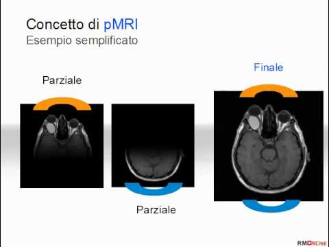 Articolazioni Uzi Ryazan Dove Tecniche di fisioterapia nel trattamento della malattia degenerativa del disco