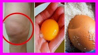 Con Esto Eliminarás El Dolor De Rodilla Por Completo | Mejor Salud