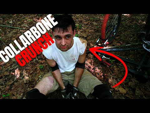 What Do Mountainbikers Do To Recover FAST From Collarbone Breaks? [RECOVERY SECRETS!]