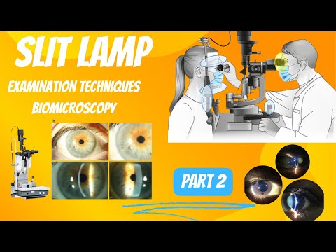 Mastering the Working Principle and Procedure of Slit Lamps Everything You Need to Know