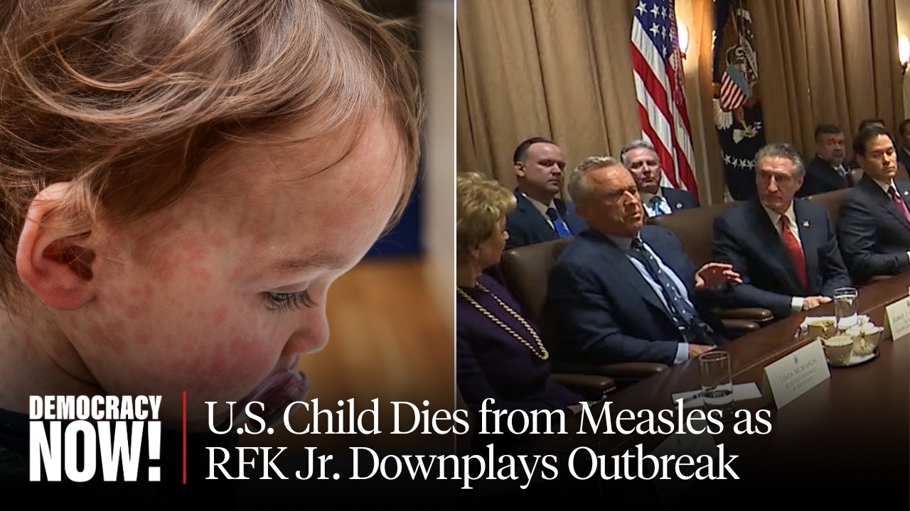 Child Dies from Measles in Texas as Disease “Comes Roaring Back” Amid Anti-Vaccine Disinformation