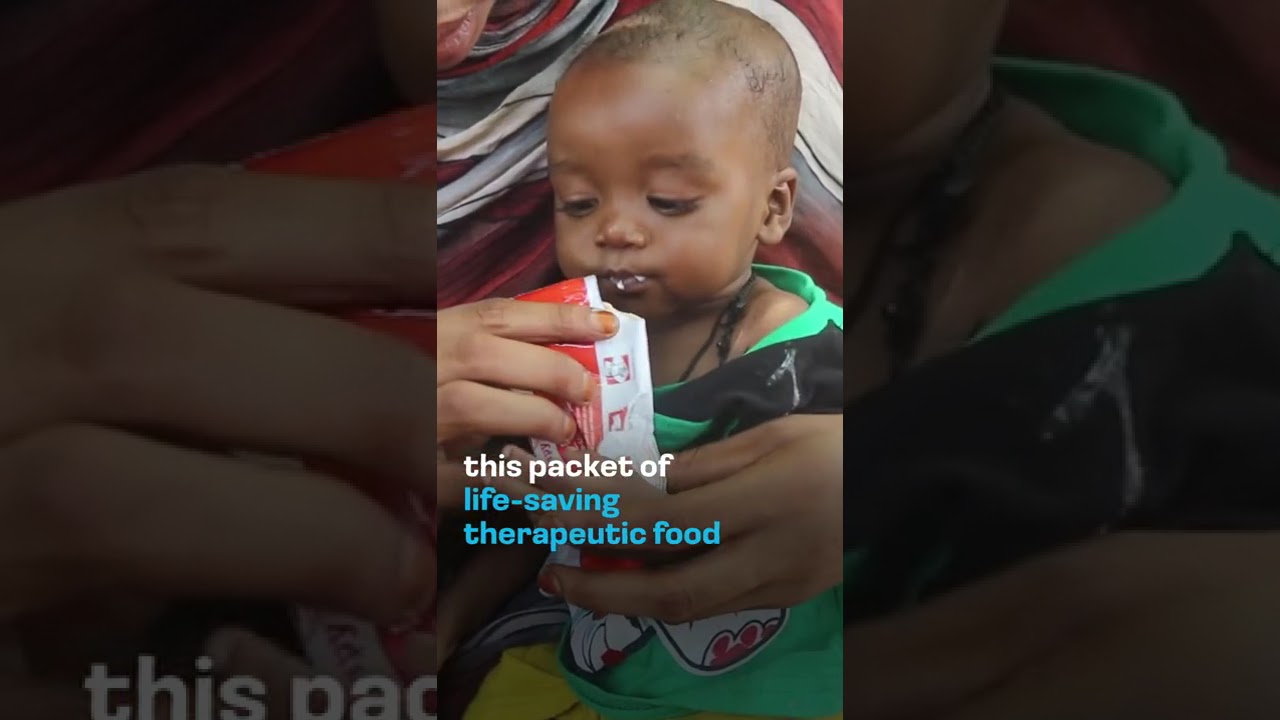 You can help deliver a Packet of Hope to malnourished children.