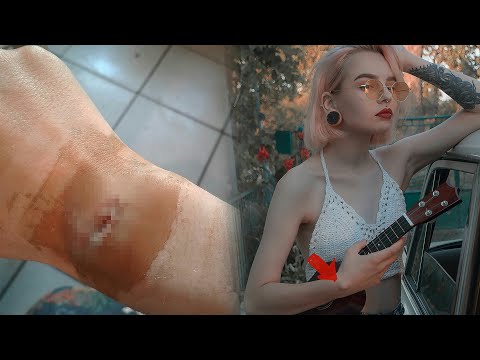 Остеохондроз шейный как бороться с Боли ниже поясницы и бёдра