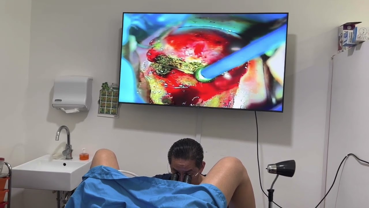 Ángel Millán Juárez-76