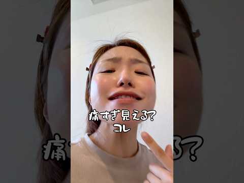 【悲報】アゴを大怪我しました…#shorts