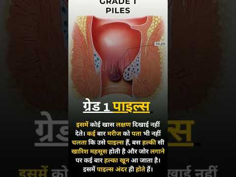 About Grade 1 Piles #youtube #shorts #shorts #piles #health