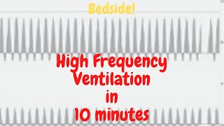 Bedside! High Frequency Ventilation in 10 minutes.